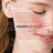 Bioderma Sensibio Ar+ Bi-Serum, 30 ml