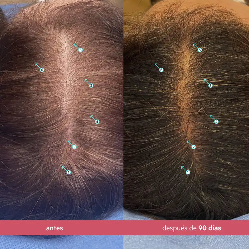 DS Laboratories Spectral Serum für Frauen zur Verbesserung der Haardichte, 60ml
