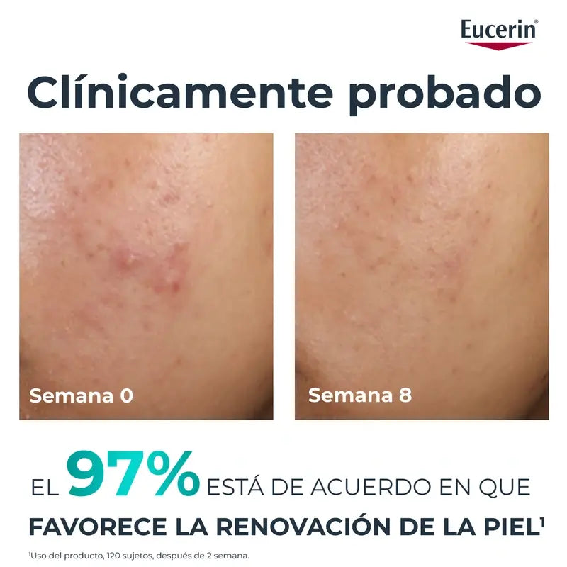 Eucerin Dermopure Peeling 10% Hydroxy-Säuren, 40 ml