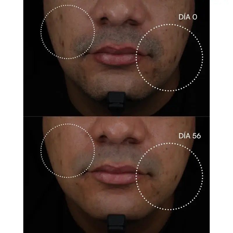 Gema Herrerías 10 Aha Chemisches Peeling, 20 Einheiten