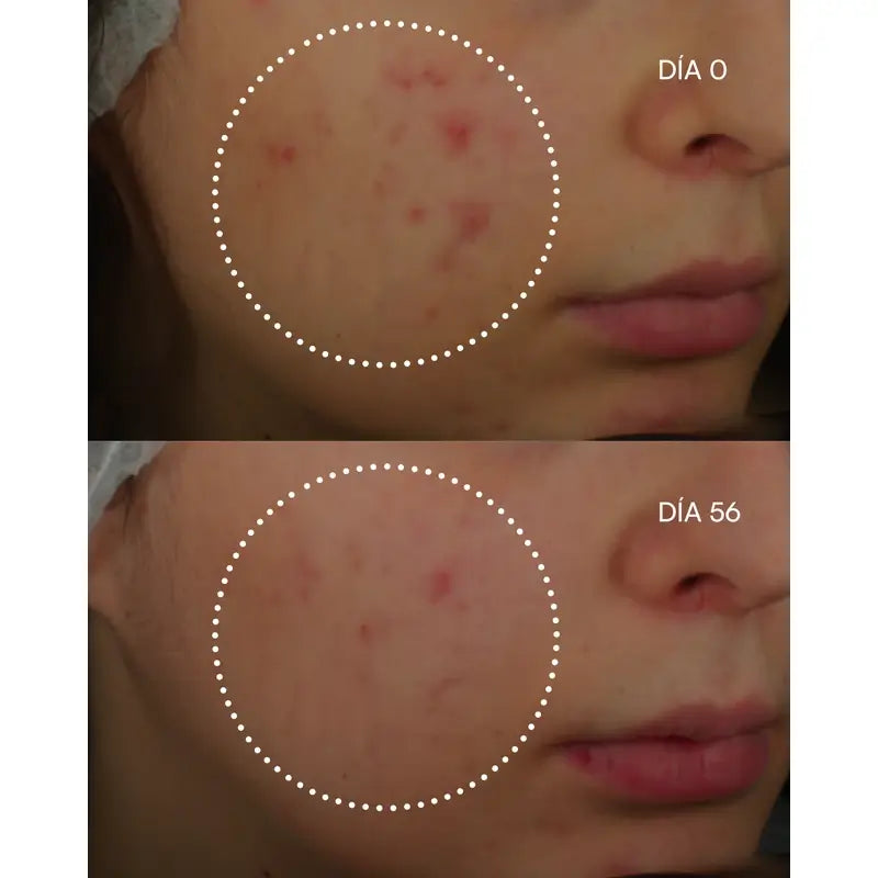 Gema Herrerías 1600 Retinal-Z Unvollkommenheiten Serum, 30 ml