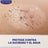 Hansaplast Second Skin Protection Spray Dressing , 40 Anwendungen