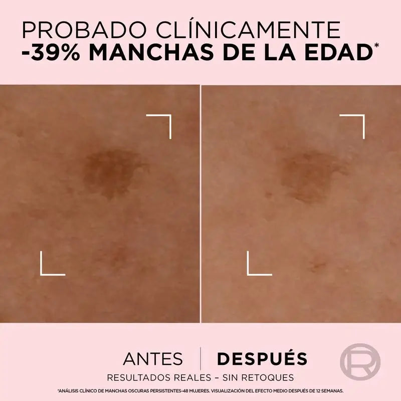 L'Oréal Paris Age Perfect Age Perfect Age Perfecting Serum für reife Haut