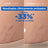 Mixa Anti-Stretch Marks Öl, 100 ml