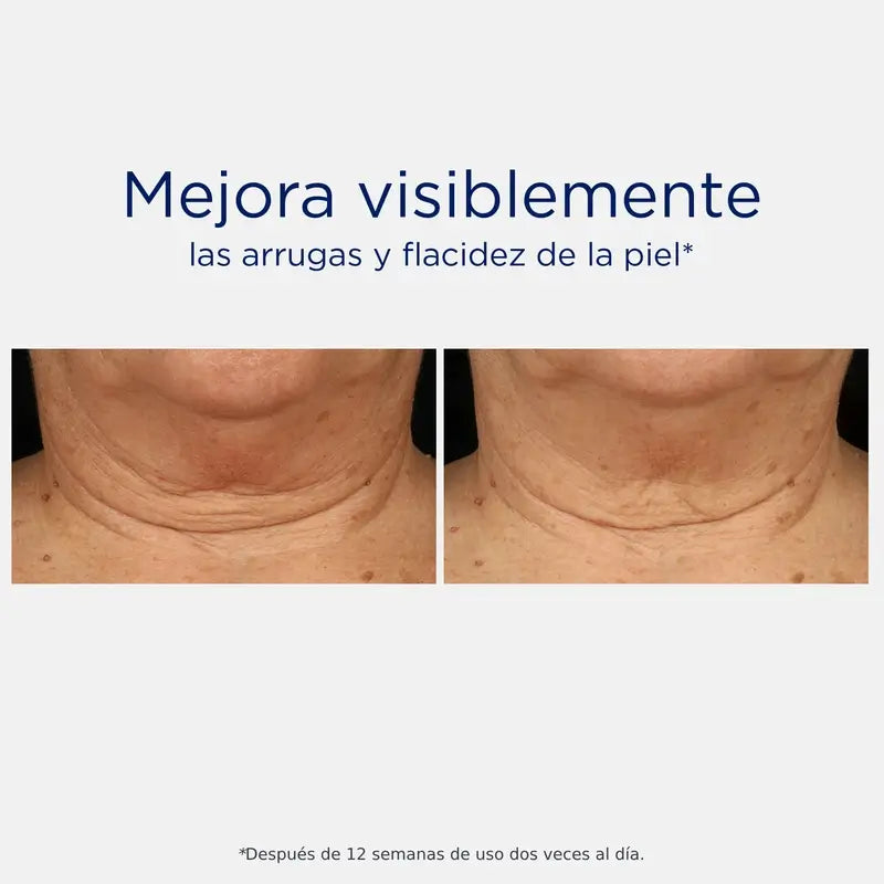 Neostrata Skin Active Tri-Therapy Lifting Serum, Hyaluronsäure-Serum 30ml