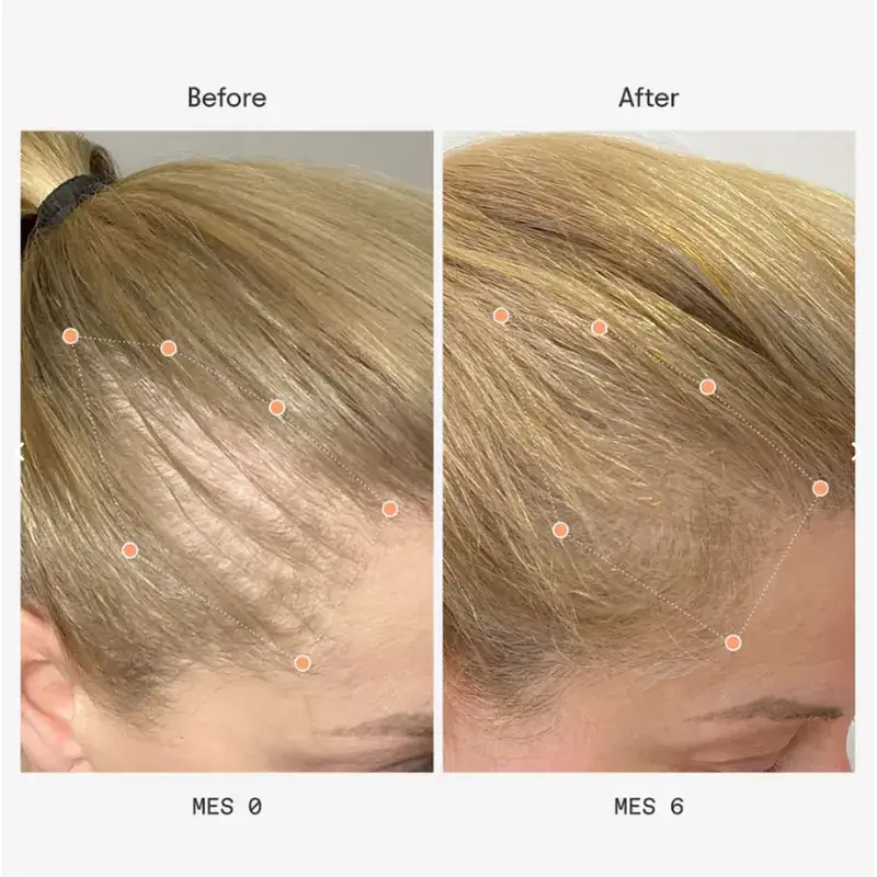 Olistic Next Women 28 Fläschchen à 25 ml