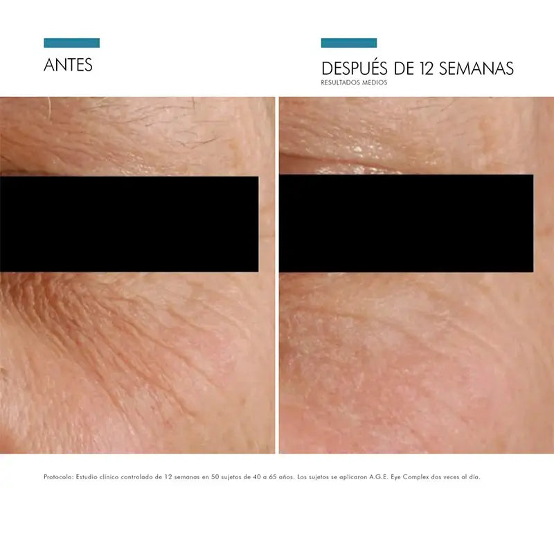 SkinCeuticals A.G.E Augen-Komplex 15 ml