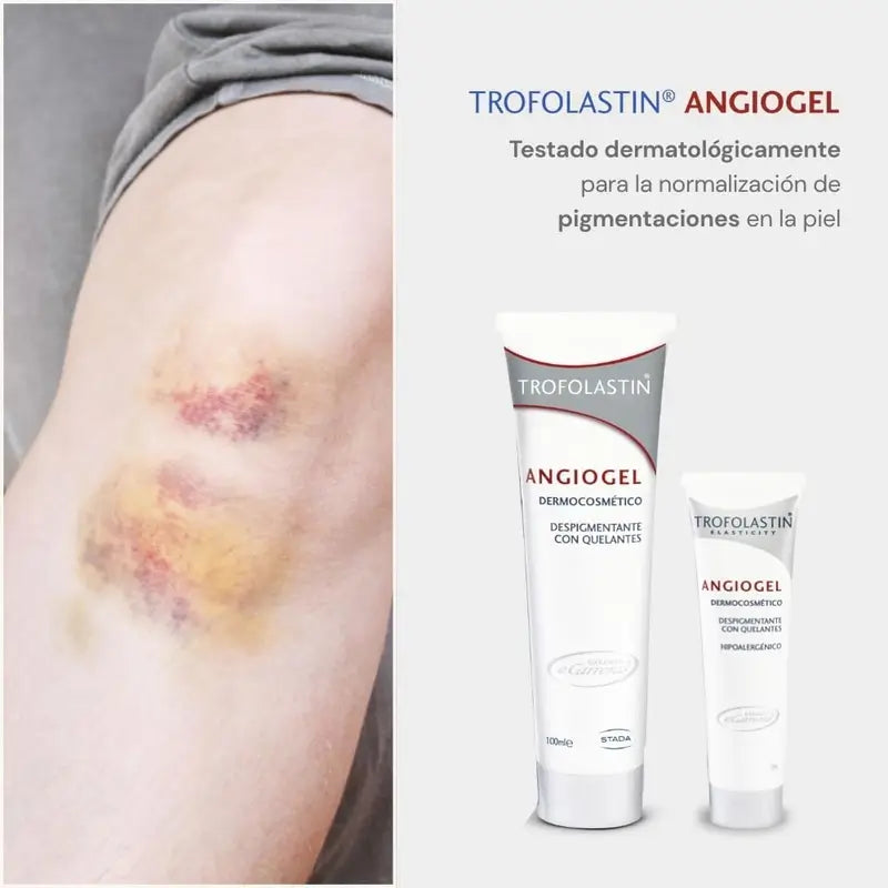 Trofolastin Angiogel Depigmentierungscreme, 2x100 ml