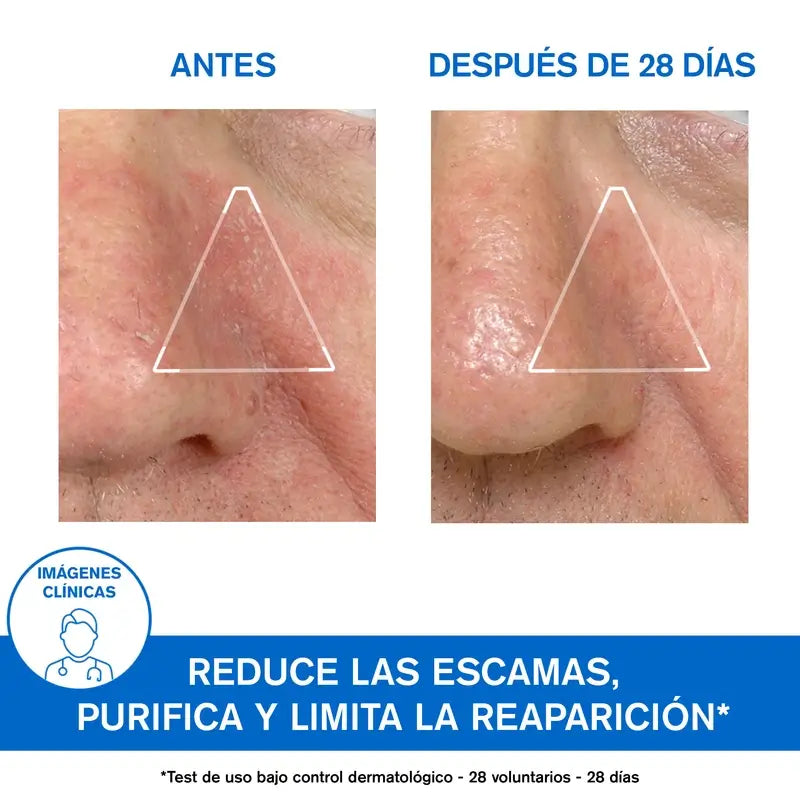 Uriage Ds Beruhigende Emulsion 40Ml Unparfümiert